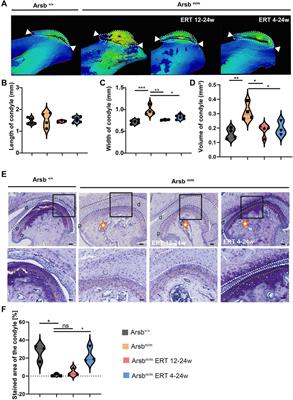 Early enzyme replacement therapy prevents dental and craniofacial abnormalities in a mouse model of mucopolysaccharidosis type VI